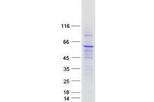 Interferon-Induced Protein with Tetratricopeptide Repeats 5 (IFIT5) protein (Myc-DYKDDDDK Tag)