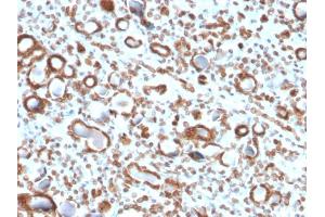 Immunohistochemistry (IHC) image for anti-Emerin (EMD) (AA 56-167) antibody (ABIN6939303)