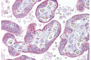 Immunohistochemistry with Placenta tissue at an antibody concentration of 5µg/ml using anti-TRPC4 antibody (ARP35256_P050) (TRPC4 antibody  (Middle Region))