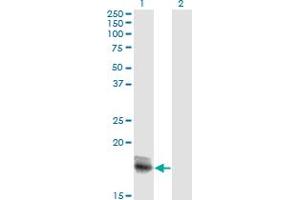 Western Blot analysis of IL15 expression in transfected 293T cell line by IL15 monoclonal antibody (M18), clone 2F9.