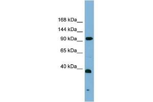 WB Suggested Anti-ERCC4 Antibody Titration: 0.