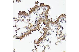 Immunohistochemistry of paraffin-embedded mouse lung using  Rabbit mAb (ABIN7265788) at dilution of 1:100 (40x lens). (ATG12 antibody)