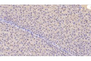 Detection of CHEM in Human Liver Tissue using Monoclonal Antibody to Chemerin (CHEM) (Chemerin antibody  (AA 33-158))