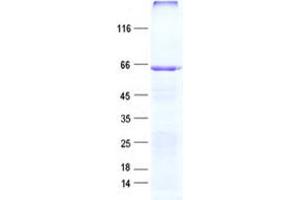 Validation with Western Blot (NOS1AP Protein (His tag))