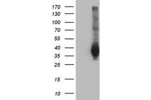 Western Blotting (WB) image for anti-Family with Sequence Similarity 84, Member B (FAM84B) antibody (ABIN1498212) (FAM84B antibody)
