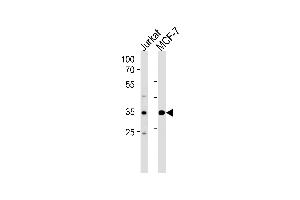 ATF4 Antibody (Center) (ABIN656176 and ABIN2845506) western blot analysis in Jurkat,MCF-7 cell line lysates (35 μg/lane). (ATF4 antibody  (AA 171-198))