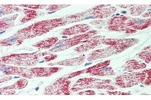 Detection of SMAD9 in Human Heart Tissue using Polyclonal Antibody to SMAD family member 9 (SMAD9) (SMAD9 antibody  (AA 226-459))