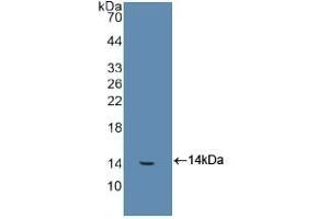 Detection of Recombinant FGb, Human using Polyclonal Antibody to Fibrinogen Beta Chain (FGB) (Fibrinogen beta Chain antibody  (AA 29-118))