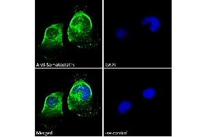 ABIN7013881 Immunofluorescence analysis of paraformaldehyde fixed U251 cells, permeabilized with 0. (Somatostatin antibody  (AA 58-70))