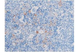ABIN6267553 at 1/200 staining Mouse spleen tissue sections by IHC-P. (LIMK-1/2 (pThr505), (pThr508) antibody)