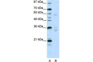 Western Blotting (WB) image for anti-Zinc Finger Protein 440 (ZNF440) antibody (ABIN2461986) (ZNF440 antibody)