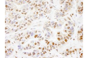 Immunohistochemistry (IHC) image for anti-PHD Finger Protein 8 (PHF8) (AA 650-700) antibody (ABIN7448725) (PHF8 antibody  (AA 650-700))