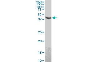anti-Egf-Like Module Containing, Mucin-Like, Hormone Receptor-Like 4 Pseudogene (EMR4P) (AA 21-93) antibody