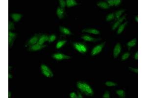 Immunofluorescent analysis of Hela cells using ABIN7161869 at dilution of 1:100 and Alexa Fluor 488-congugated AffiniPure Goat Anti-Rabbit IgG(H+L) (NCOR1 antibody  (AA 1770-1947))