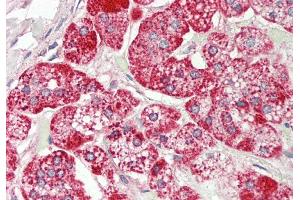 Rabbit Anti-Rps12 antibody Catalog Number: ARP51260 Formalin Fixed Paraffin Embedded Tissue: Human Adrenal Primary antibody Concentration: 1:100 Secondary Antibody: Donkey anti-Rabbit-Cy3 Secondary Antibody Concentration: 1:200 Magnification: 20x Exposure Time: 0. (RPS12 antibody  (C-Term))
