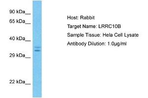 Host: Rabbit Target Name: LRRC10B Sample Type: Hela Whole Cell lysates Antibody Dilution: 1. (LRRC10B antibody  (C-Term))