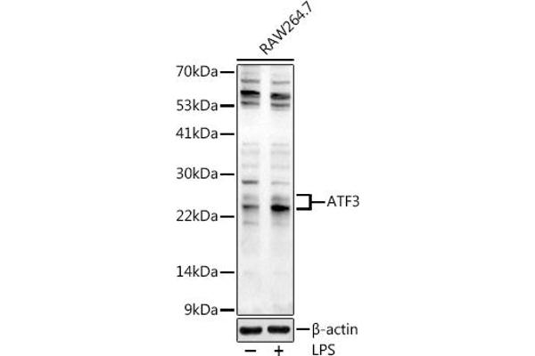 ATF3 抗体  (AA 1-181)