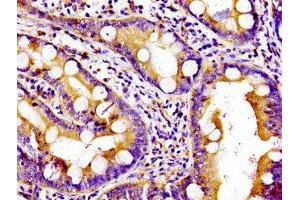 Immunohistochemistry of paraffin-embedded human small intestine tissue using ABIN7157571 at dilution of 1:100 (KIF5B antibody  (AA 338-514))