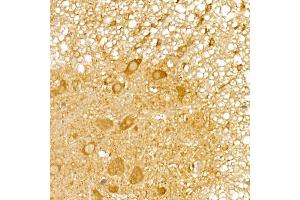Immunohistochemistry of paraffin-embedded mouse spinal cord using TRIM21/SS-A Rabbit pAb (ABIN6131376, ABIN6149506, ABIN6149507 and ABIN6217587) at dilution of 1:50 (40x lens). (TRIM21 antibody  (AA 80-330))