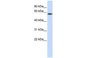 SPTLC1 antibody used at 1 ug/ml to detect target protein. (SPTLC1 antibody  (Middle Region))