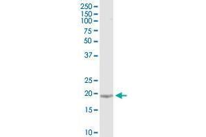 KIAA1143 monoclonal antibody (M07), clone 4E11. (KIAA1143 antibody  (AA 1-154))