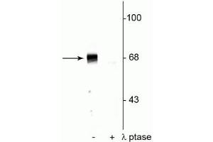 Western blot of rat hippocampal lysate showing specific immunolabeling of the ~68 kDa to ~70 kDa PAK protein phosphorylated at Ser402 in the first lane (-). (PAK1 antibody  (pThr402))