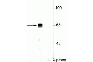 Western blot of rat hippocampal lysate showing specific immunolabeling of the ~68 kDa to ~70 kDa PAK protein phosphorylated at Ser402 in the first lane (-). (PAK1-3 (pThr402) antibody)