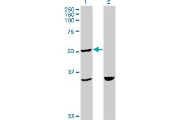 TTC4 anticorps  (AA 1-100)