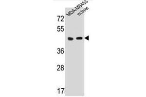 Western blot analysis of HTR4 Antibody (N-term) in MDA-MB453 cell line and mouse liver tissue lysates (35ug/lane). (Serotonin Receptor 4 antibody  (N-Term))