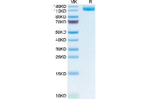 LIFR Protein (AA 45-833) (His tag)