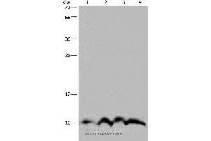 Western blot analysis of SKOV3 cell and human fetal liver tissue, human fetal brain tissue and Hela cell, using NDUFA4 Polyclonal Antibody at dilution of 1:300 (NDUFA4 antibody)