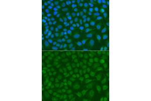 Immunofluorescence analysis of A549 cell using SSX5 antibody. (SSX5 antibody)