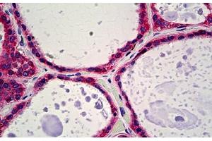 Human Thyroid: Formalin-Fixed, Paraffin-Embedded (FFPE) (Calreticulin antibody)