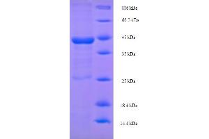 SDS-PAGE (SDS) image for p40 (p63 Delta) (AA 1-354), (full length) protein (His tag) (ABIN5710756)