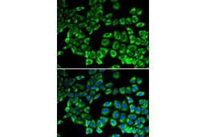 Immunofluorescence analysis of HeLa cells using AIMP1 antibody (ABIN5973047). (AIMP1 antibody)