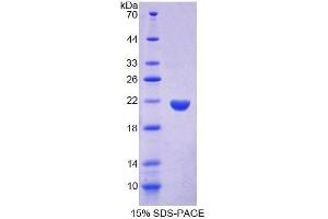 SDS-PAGE analysis of Rat PTPN13 Protein.