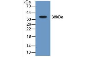 Detection of Recombinant MAOB, Mouse using Polyclonal Antibody to Monoamine Oxidase B (MAOB) (Monoamine Oxidase B antibody  (AA 206-505))