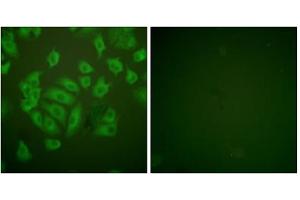 Immunofluorescence analysis of A549 cells, using Stefin A antibody. (CSTA antibody  (Internal Region))