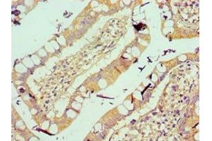 Immunohistochemistry of paraffin-embedded human small intestine tissue using ABIN7175561 at dilution of 1:100 (Vitronectin antibody  (AA 364-478))