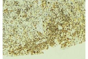 ABIN6276554 at 1/100 staining Mouse pancreas tissue by IHC-P. (EGLN1 antibody  (Internal Region))