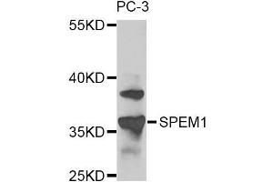 Western blot analysis of extracts of PC-3 cells, using SPEM1 antibody. (SPEM1 antibody)