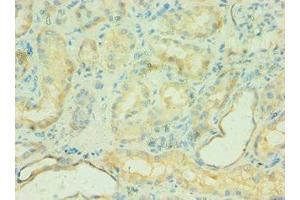 Immunohistochemistry of paraffin-embedded human kidney tissue using ABIN7146168 at dilution of 1:100 (C4BPB antibody  (AA 18-252))