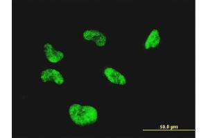 Immunofluorescence of monoclonal antibody to CGGBP1 on HeLa cell. (CGGBP1 antibody  (AA 58-167))