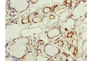 Immunohistochemistry of paraffin-embedded human thyroid tissue using ABIN7142705 at dilution of 1:100 (PGLS antibody  (AA 1-258))