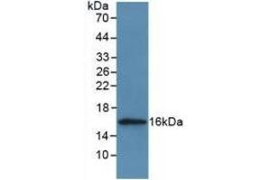 Detection of Recombinant CSTA, Human using Polyclonal Antibody to Cystatin A (CSTA) (CSTA antibody  (AA 1-98))