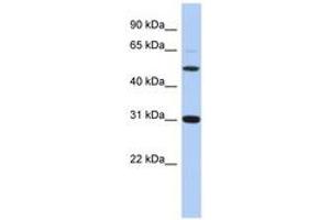 Image no. 1 for anti-Peptidase Inhibitor 16 (PI16) (C-Term) antibody (ABIN6743848) (PI16 antibody  (C-Term))