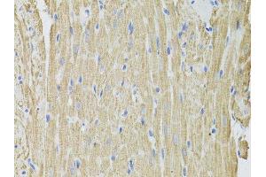 Immunohistochemistry of paraffin-embedded rat heart using FHIT antibody. (FHIT antibody  (AA 25-147))
