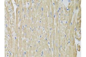 Immunohistochemistry of paraffin-embedded rat heart using FHIT antibody. (FHIT antibody  (AA 25-147))