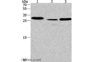 Western blot analysis of Human fetal liver tissue and mouse heart tissue,human testis tissue, using IRAK1BP1 Polyclonal Antibody at dilution of 1:475 (IRAK1BP1 antibody)