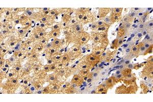 Detection of CRP in Porcine Liver Tissue using Polyclonal Antibody to C Reactive Protein (CRP) (CRP antibody  (AA 20-222))